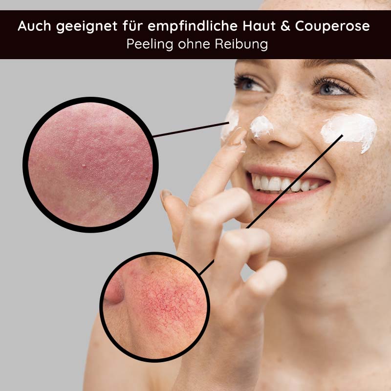 Rau Cosmetics Fruit Acid Peeling 100 ml Fruchtsäurepeeling mit BHA Letzte 3 Tage