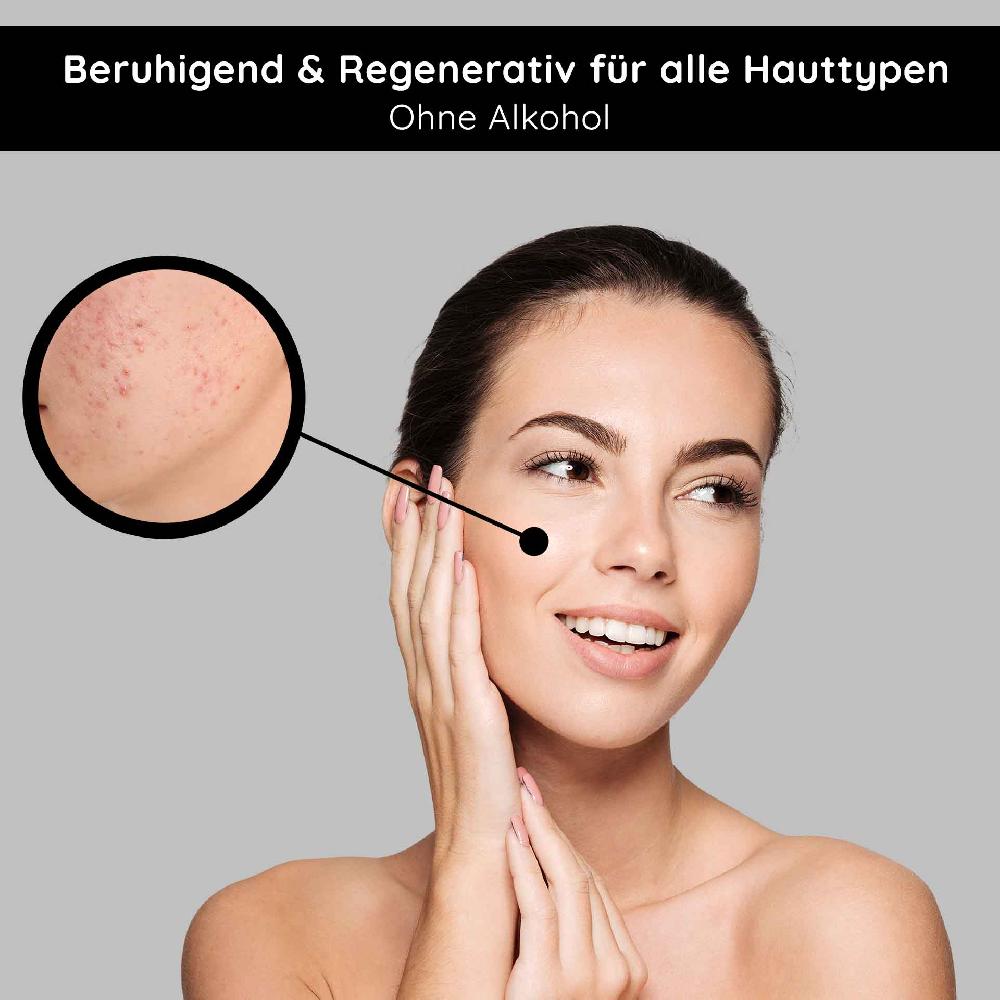 Rau Cosmetics Tonic alcohol-free 200 ml mit Brennnessel-Extrakt Letzter Tag